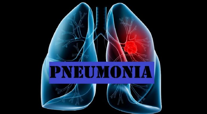 Gejala Pneumonia