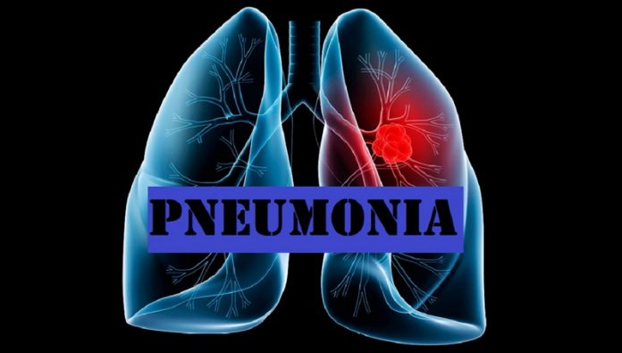 Gejala Pneumonia